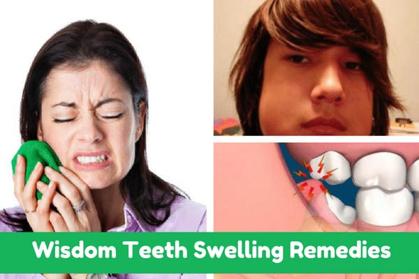 How To Get Rid Of Swelling After Wisdom Teeth Removal