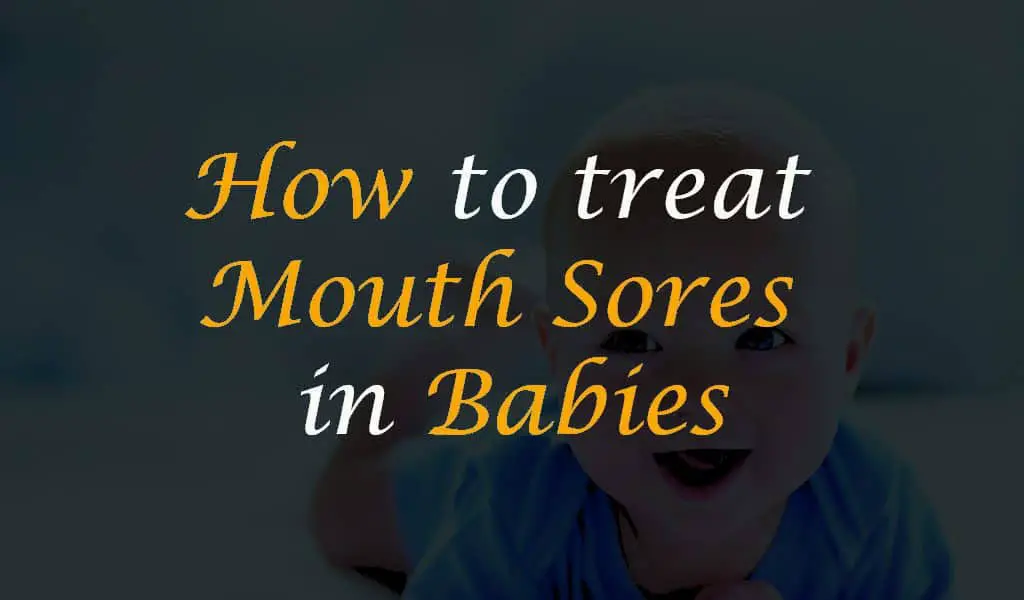 how to treat mouth sores in babies
