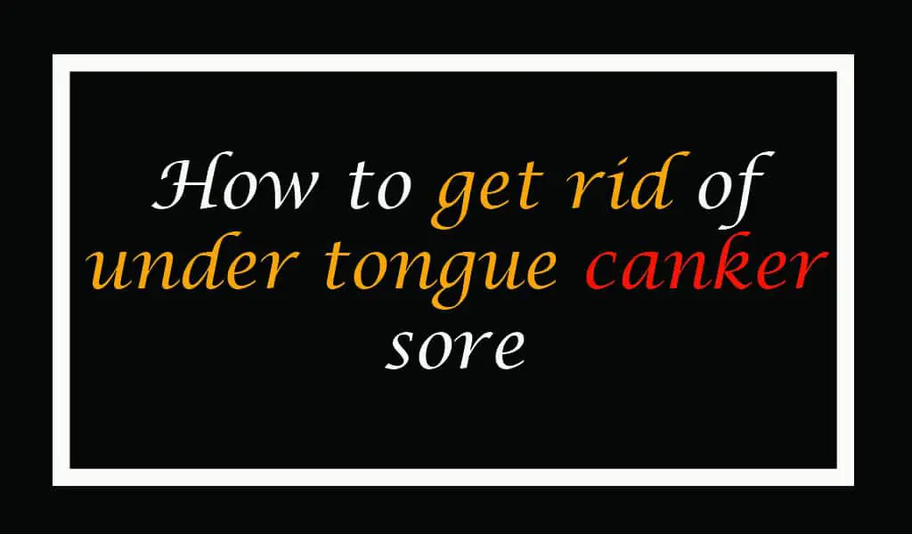 How to get rid of under tongue canker sore (Very Fast)