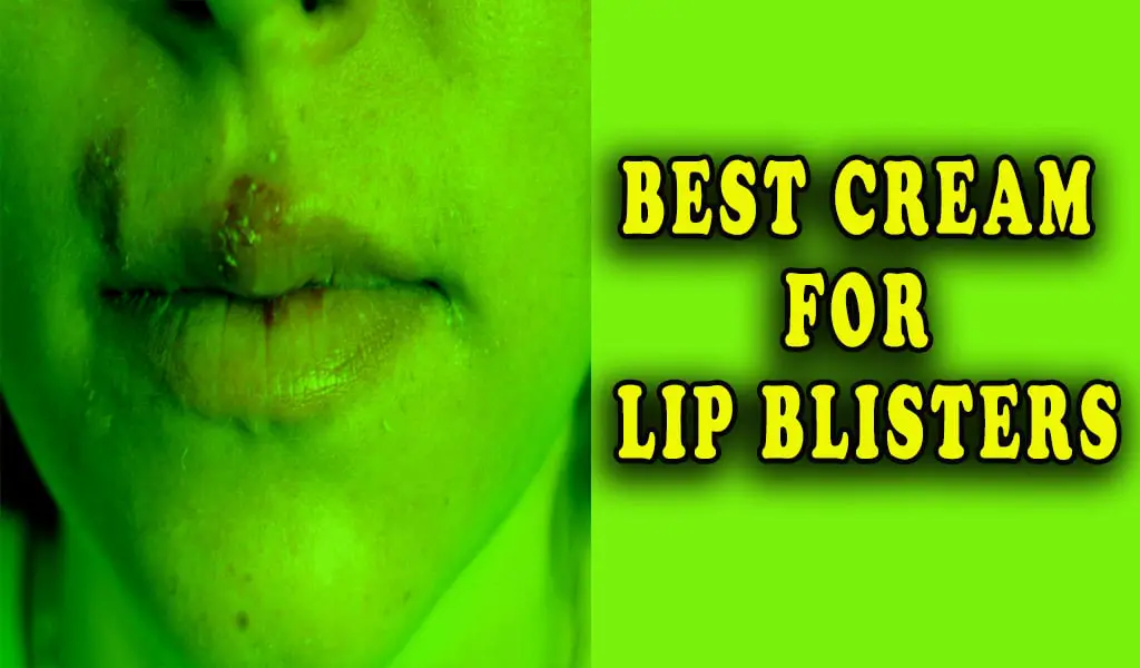 Best cream for Lip Blisters (Antiviral Creams for Cold Sores)